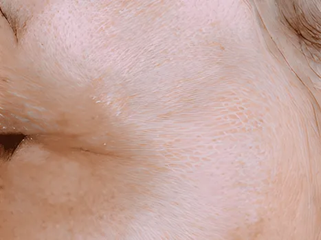 Luomen poisto after example 1